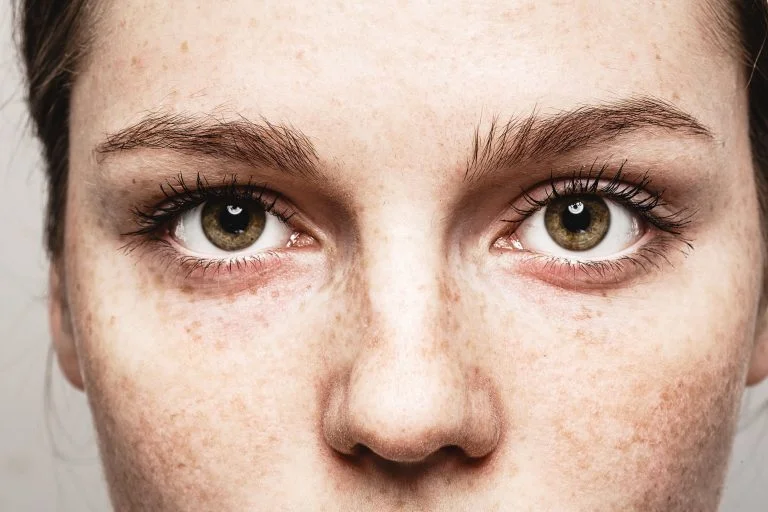 Big hazel eyes in a freckled face